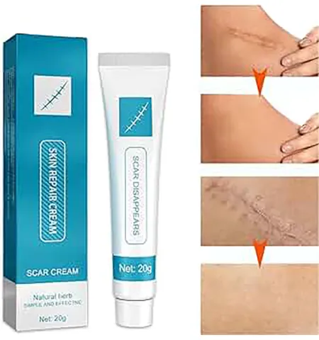 20g Scar and Acne Marks Removal Gel, Scars, Burns, Stretch Marks
