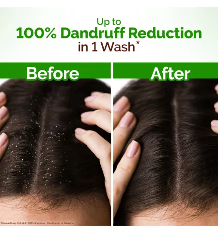 Mamaearth Lemon Anti-Dandruff Shampoo