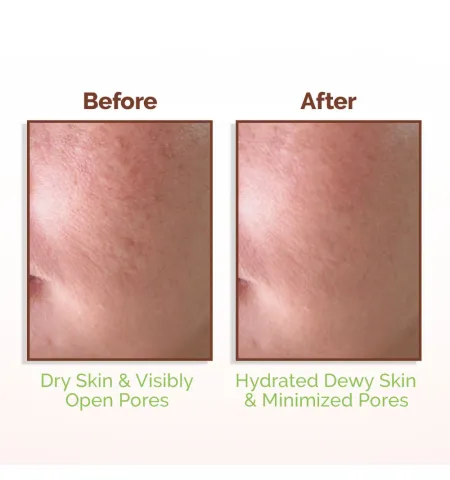 Mamaearth Rice Water Dewy Face Toner with 4% Niacinamide for Glass Skin and All Skin Types