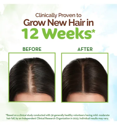 Mamaearth Rosemary Hair Growth Oil With Rosemary & Methi Dana