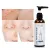 Melao Salicylic Acid Cleanser: 100 ml